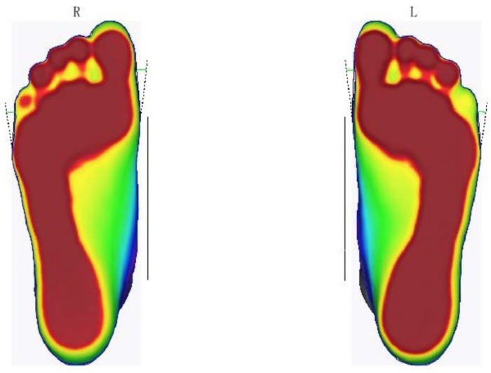 3D scanner voor hele voet 11,5cm - Afbeelding 6